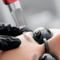 The Ins and Outs of Microblading Removal in NYC