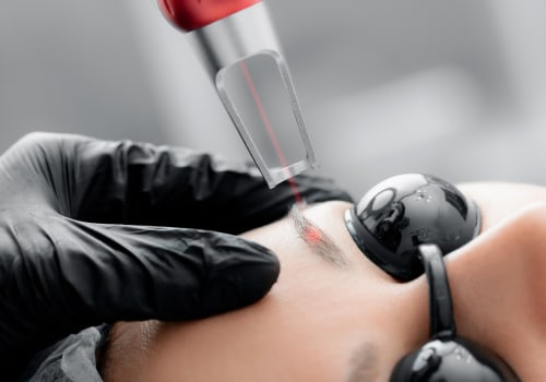 The Ins and Outs of Microblading Removal in NYC